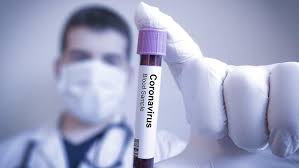 Azərbaycanda daha 63 nəfərdə koronavirus aşkarlandı